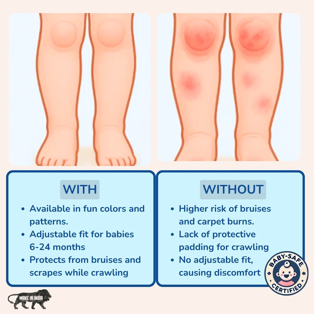 Non-Slip Baby Knee Pads for Safe Crawling (Pack of 5)